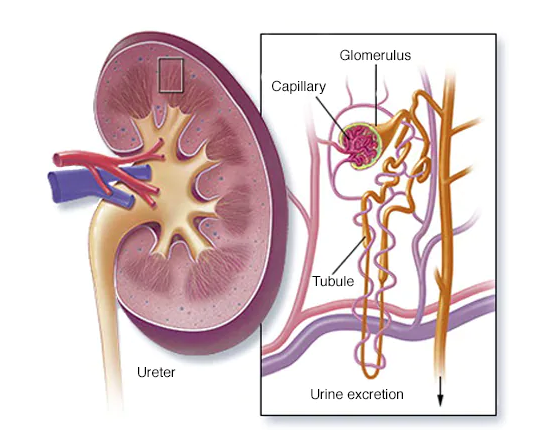 kidney failure symptoms and causes